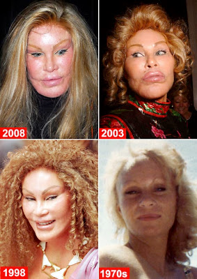 Cosmetic surgery can SO age a girl