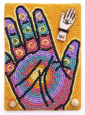 my hand (beaded), before onset of Dupuytren's Disease my hand (beaded), before onset of Dupuytren's Disease