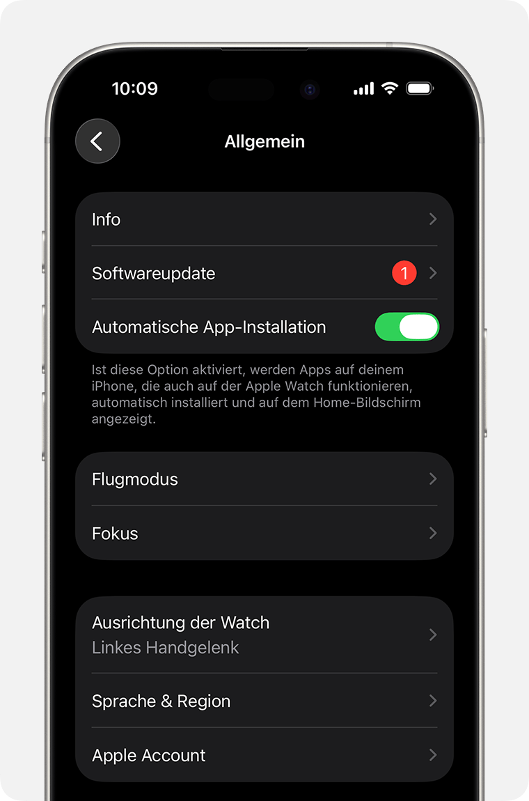 iPhone-Display mit den allgemeinen Einstellungen