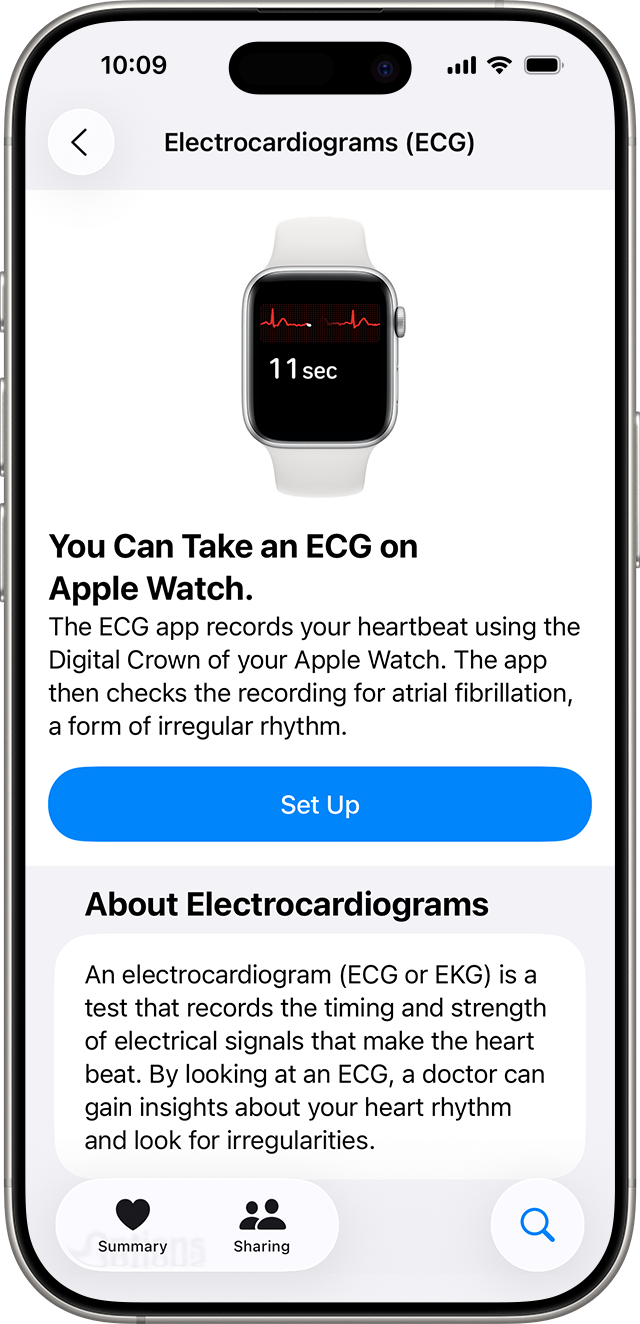 The ECG set up screen within the Health app on iPhone