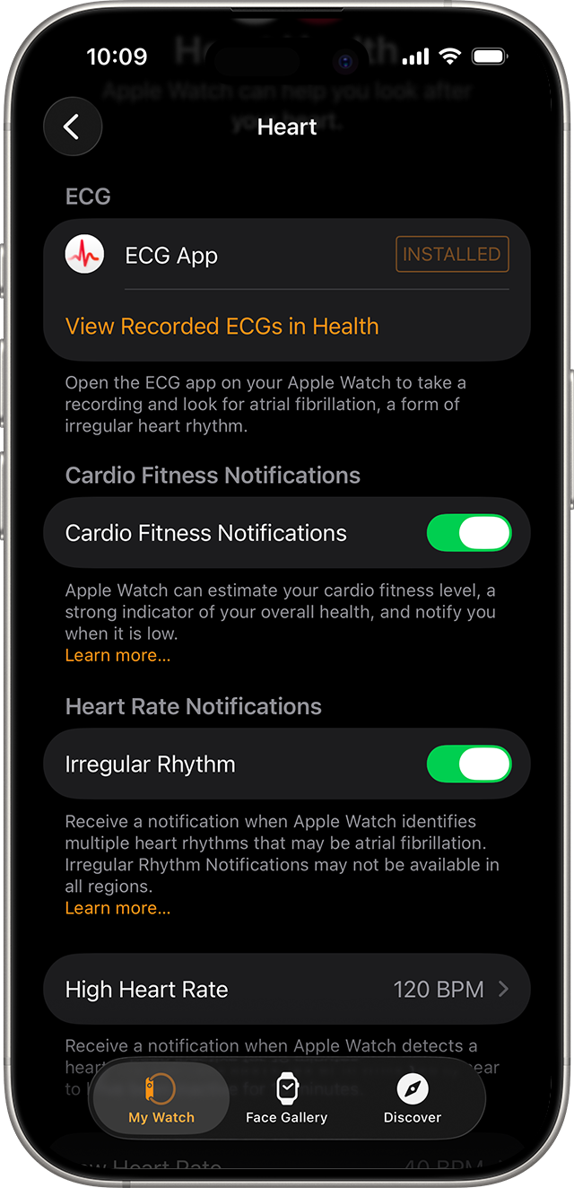 „iPhone“, kurio „Apple Watch“ programoje rodomi „Širdies būklės“ nustatymai.