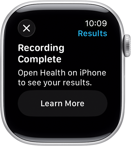 An Apple Watch that shows a recording complete message at the end of a blood oxygen measurement.