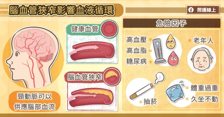 腦血管中風