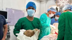 हरे रंग का गाउन और फेस मास्क पहने एक सर्जन अपने हाथों में एक बड़ी पित्त पथरी लिए हुए पोज दे रहा है.