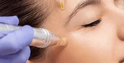 A person receives a facial treatment with a cosmetic device while a dropper applies serum to the forehead. A person receives a facial treatment with a cosmetic device while a dropper applies serum to the forehead.