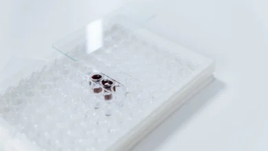 Photo of Alcohol-related liver disease RNA splicing errors may block recovery even after abstinence