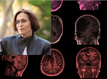 Image of Marlene Behrmann and brain images